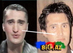 Şou-biznesimizin plastik əməliyyat keçirən simaları